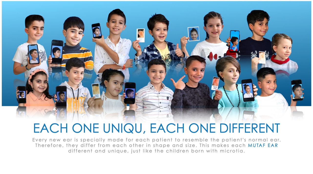 congenital absence of ears