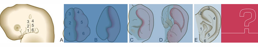 WHAT CAUSES MICROTIA?