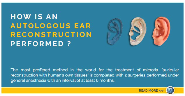 How to make ears with our own tissues.